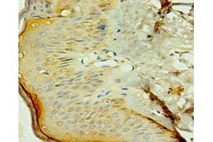 Immunohistochemistry of paraffin-embedded human skin tissue using ABIN7161904 at dilution of 1:100