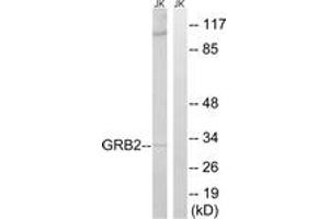 Western blot analysis of extracts from Jurkat cells, using GRB2 Antibody. (GRB2 anticorps  (AA 141-190))