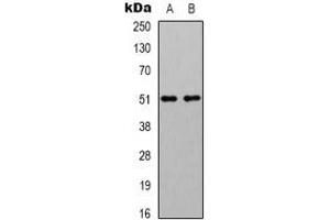 Western blot analysis of GABRA2 expression in mouse brain (A), rat brain (B) whole cell lysates. (GABRA2 anticorps)