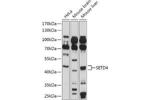 Western blot analysis of extracts of various cell lines, using SETD4 antibody (ABIN7270264) at 1:1000 dilution. (SETD4 anticorps  (AA 210-300))