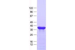 Validation with Western Blot