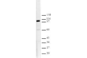 L3MBTL1 antibody tested by Western blot. (L3MBTL1 anticorps  (AA 1-215))