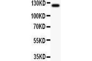 Anti-TIE2 Picoband antibody,  All lanes: Anti TIE2  at 0.