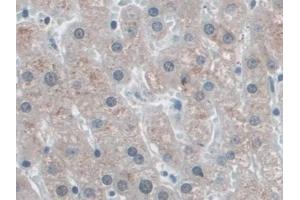 Detection of SNRPD1 in Human Liver Tissue using Polyclonal Antibody to Small Nuclear Ribonucleoprotein Polypeptide D1 (SNRPD1) (SNRPD1 anticorps  (AA 1-119))