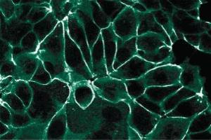 Immunofluorescence staining of MCF7 cells. (JUP anticorps  (AA 553-738))