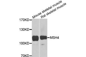 Western blot analysis of extracts of various cells, using MSH4 antibody. (MSH4 anticorps)