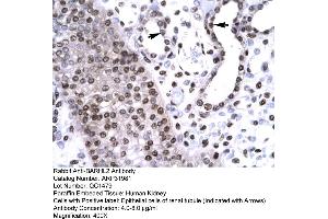 Human kidney (BARHL2 anticorps  (Middle Region))