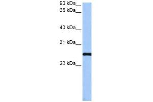 CCDC46 antibody used at 1 ug/ml to detect target protein.