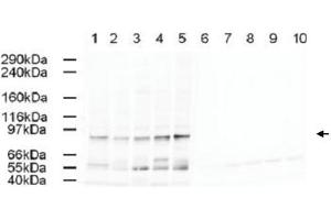 Western blot using AP2A1 polyclonal antibody  shows detection of a band just below 100 KDa correspond-ing to Human AP2A1 in a various preparations.
