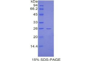 SDS-PAGE analysis of Mouse CREB Binding Protein.