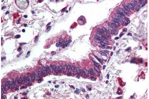 Human Lung, Respiratory Epithelium (formalin-fixed, paraffin-embedded) stained with ERBB3 antibody ABIN305733 at 5 ug/ml followed by biotinylated anti-goat IgG secondary antibody ABIN481715, alkaline phosphatase-streptavidin and chromogen. (ERBB3 anticorps  (AA 1330-1342))