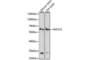 Western blot analysis of extracts of various cell lines, using ZNF331 antibody.