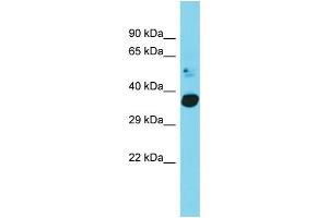 Host: Rabbit Target Name: C20orf72 Sample Type: Fetal Heart lysates Antibody Dilution: 1. (C20orf72 anticorps  (C-Term))