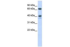 Image no. 1 for anti-Angiotensin II Receptor, Type 1 (AGTR1) (AA 37-86) antibody (ABIN6740751) (Angiotensin II Type-1 Receptor anticorps  (AA 37-86))
