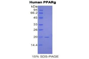 SDS-PAGE (SDS) image for Peroxisome Proliferator-Activated Receptor gamma (PPARG) (AA 349-488) protein (His tag) (ABIN1877737) (PPARG Protein (AA 349-488) (His tag))