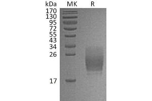 Western Blotting (WB) image for CD160 (CD160) protein (His tag) (ABIN7320849) (CD160 Protein (CD160) (His tag))