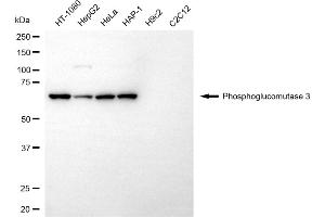 Western blotting analysis using phosphoglucomutase 3 antibody (ABIN7799806).