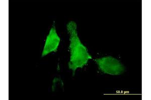 Immunofluorescence of purified MaxPab antibody to ALOX12 on HeLa cell. (ALOX12 anticorps  (AA 1-663))