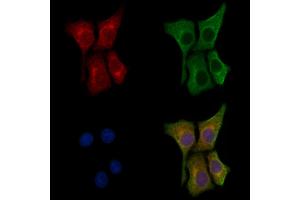ABIN6258295 and ABIN6273964 staining HepG2 cells by IF/ICC. (OPRL1 anticorps  (C-Term))