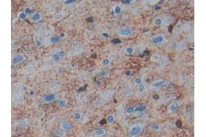 DAB staining on IHC-P; Samples: Rat Cerebrum Tissue (S100B anticorps  (AA 1-92))