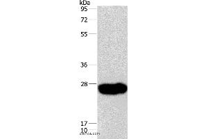 Western blot analysis of Human fetal muscle tissue, using CAV3 Polyclonal Antibody at dilution of 1:550 (Caveolin 3 anticorps)