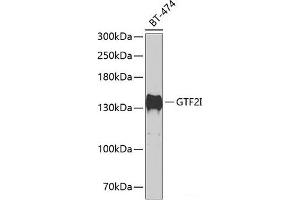 Western blot analysis of extracts of BT-474 cells using GTF2I Polyclonal Antibody at dilution of 1:500. (GTF2I anticorps)