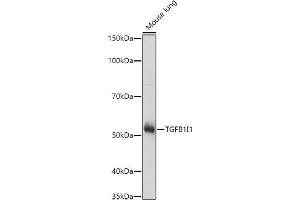 Western blot analysis of extracts of Mouse lung, using TGFB1I1 antibody (ABIN6129144, ABIN6149074, ABIN6149075 and ABIN6224526) at 1:1000 dilution. (TGFB1I1 anticorps  (AA 1-150))