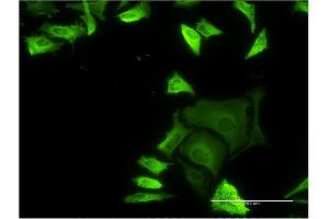 Immunofluorescence of monoclonal antibody to FLNA on HeLa cell.