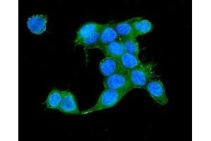 IF analysis of IQGAP2 using anti-IQGAP2 antibody (ABIN5692877). (IQGAP2 anticorps  (AA 1329-1544))