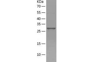 Western Blotting (WB) image for Pyrroline-5-Carboxylate Reductase 3 (PYCRL) (AA 1-274) protein (His tag) (ABIN7124718)