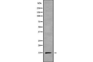 Western blot analysis of RPS15A using LOVO whole cell lysates (RPS15A anticorps  (Internal Region))