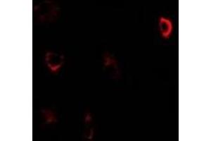 Immunofluorescent analysis of CBS staining in U2OS cells. (CBS anticorps)