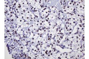 Image no. 2 for anti-Decapping Enzyme, Scavenger (DCPS) antibody (ABIN1497781) (DCPS anticorps)