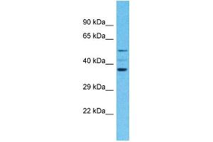 Western Blotting (WB) image for anti-Olfactory Receptor, Family 4, Subfamily F, Member 4 (OR4F4) (C-Term) antibody (ABIN2791736)