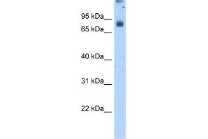 WB Suggested Antibody Titration:  2. (POR anticorps  (N-Term))