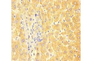 Immunohistochemistry of paraffin-embedded human liver tissue using ABIN7144419 at dilution of 1:100