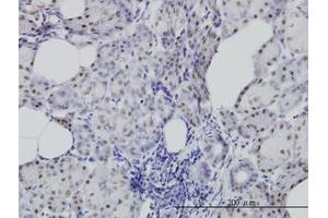 Image no. 2 for anti-Cell Division Cycle 25 Homolog C (S. Pombe) (CDC25C) (AA 21-130) antibody (ABIN598558) (CDC25C anticorps  (AA 21-130))