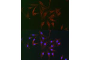 Immunofluorescence analysis of NIH/3T3 cells using FB2 Rabbit pAb (ABIN7267111) at dilution of 1:100 (40x lens).