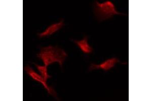 ABIN6274470 staining COLO205 by IF/ICC.