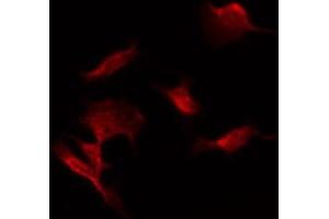 ABIN6274470 staining COLO205 by IF/ICC. (ORCTL-2/SLC22A18 anticorps  (C-Term))