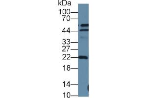 Detection of DTYMK in Human A549 cell lysate using Polyclonal Antibody to Deoxythymidylate Kinase (DTYMK) (DTYMK anticorps  (AA 43-190))