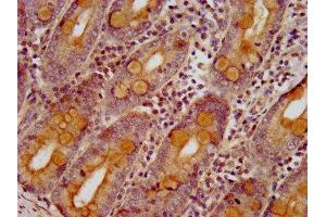 IHC image of ABIN7170211 diluted at 1:400 and staining in paraffin-embedded human small intestine tissue performed on a Leica BondTM system.