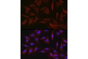 Immunofluorescence analysis of NIH-3T3 cells using BDKRB1 Rabbit pAb (ABIN7265910) at dilution of 1:250 (40x lens). (BDKRB1 anticorps  (AA 1-100))