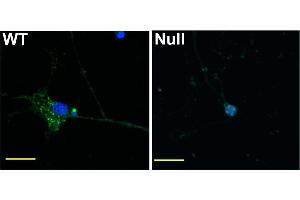 Cerebellar granule cells, 16 days in culture, obtained from wild-type (WT) and Nav1.