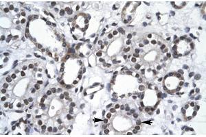 Rabbit Anti-RBM10 Antibody Catalog Number: ARP30103 Paraffin Embedded Tissue: Human Kidney Cellular Data: Epithelial cells of collecting tubule Antibody Concentration: 4. (RBM10 anticorps  (N-Term))