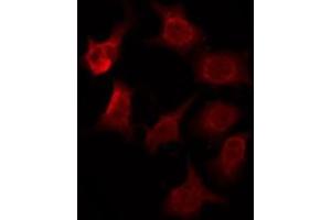 ABIN6276079 staining HuvEc by IF/ICC. (OR2T2/2T35 anticorps)