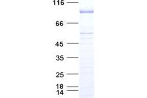 Validation with Western Blot
