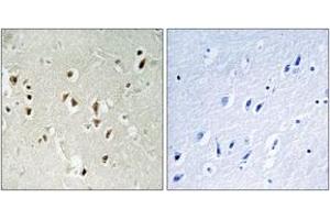 Immunohistochemistry analysis of paraffin-embedded human brain tissue, using GRF-1 (Ab-1105) Antibody. (GRLF1 anticorps  (AA 1071-1120))