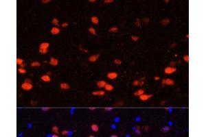 Immunofluorescence analysis of Rat brain using CALB2 Polyclonal Antibody at dilution of 1:100. (Calretinin anticorps)