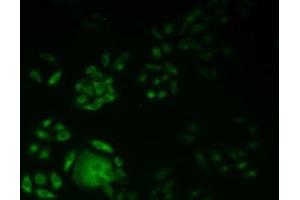 Detection of KIF18A in Human Hela Cells using Polyclonal Antibody to Kinesin Family, Member 18A (KIF18A)